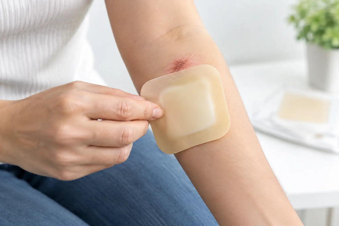 Cuándo usar apósito hidrocoloide en heridas